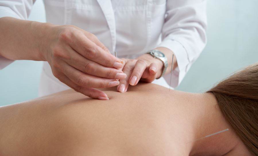 Best Acupuncturists in Auckland